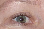 EyelashesThumb